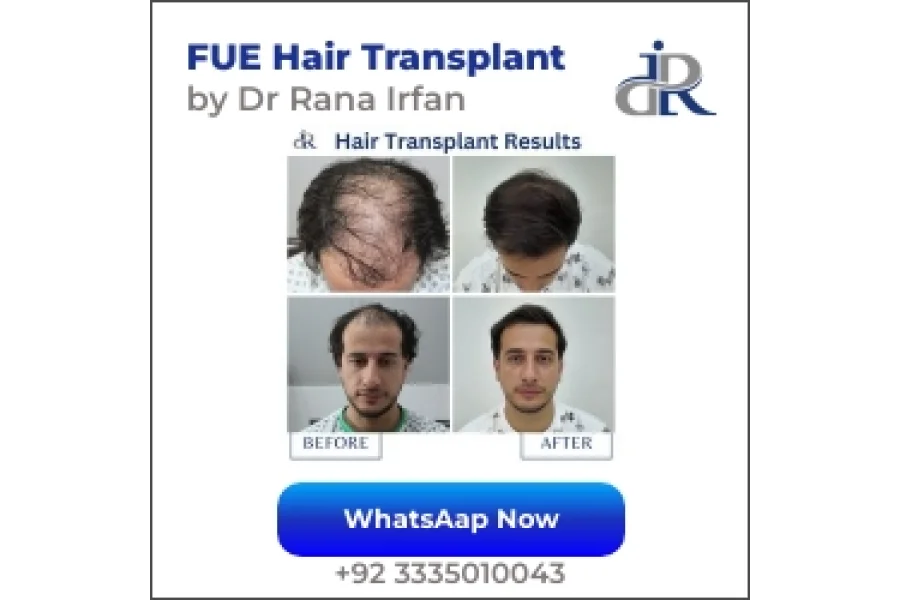FUE Hair Transplant by Dr Rana Irfan